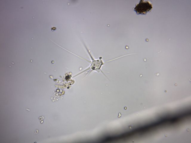 Amoeba radiosa (predazione)